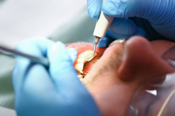 Best Urgent Tooth Repair  in Carey, OH
