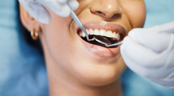 Best Tooth Pain Emergency Relief  in Carey, OH
