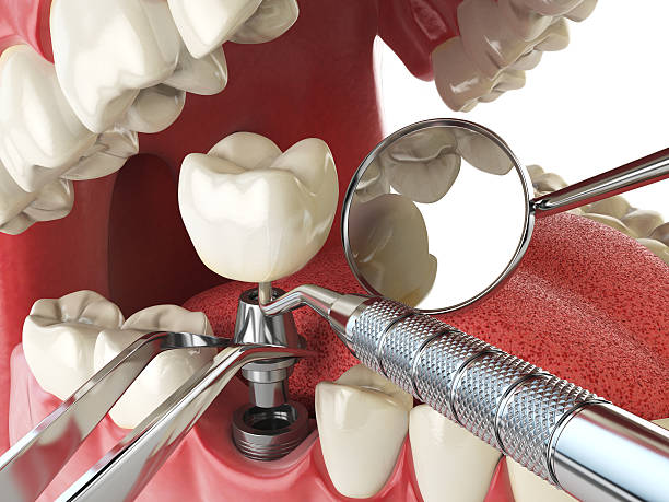 Best Tooth Pain Emergency Relief  in Carey, OH
